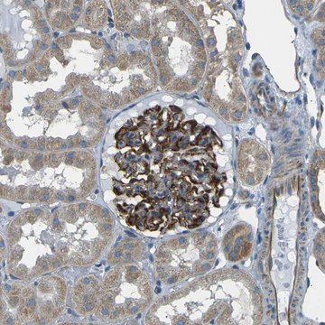 Anti-SLK antibody produced in rabbit Prestige Antibodies&#174; Powered by Atlas Antibodies, affinity isolated antibody, buffered aqueous glycerol solution