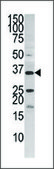 Anti-PANK3 (center) antibody produced in rabbit IgG fraction of antiserum, buffered aqueous solution