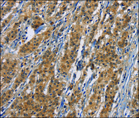Anti-PIKFYV antibody produced in rabbit affinity isolated antibody