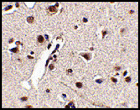 抗RKHD4 兔抗 affinity isolated antibody, buffered aqueous solution