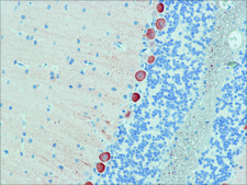 Anti-Myosin Va (LF-18) antibody produced in rabbit ~0.4 mg/mL, affinity isolated antibody, buffered aqueous solution