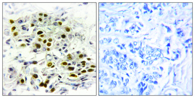 Anti-MAP3K6 antibody produced in rabbit affinity isolated antibody