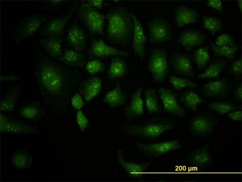 抗 DCP1A 单克隆抗体 小鼠抗 clone 3G4, purified immunoglobulin, buffered aqueous solution