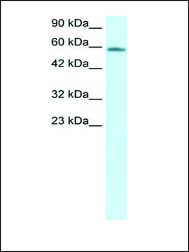 Anti-CHES1 antibody produced in rabbit IgG fraction of antiserum