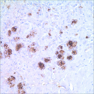 Thyroglobulin (MRQ-41) Mouse Monoclonal Antibody