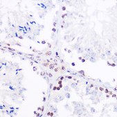 Anti-Phospho-NF-kB p65/RelA-S536 antibody produced in rabbit