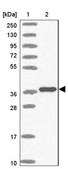 抗-TBX10 兔抗 Prestige Antibodies® Powered by Atlas Antibodies, affinity isolated antibody, buffered aqueous glycerol solution