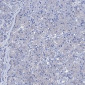 Anti-AMER2 antibody produced in rabbit Prestige Antibodies® Powered by Atlas Antibodies, affinity isolated antibody, buffered aqueous glycerol solution