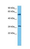 Anti-NFIA antibody produced in rabbit affinity isolated antibody