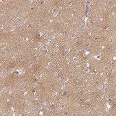 Anti-CAP2 antibody produced in rabbit Prestige Antibodies® Powered by Atlas Antibodies, affinity isolated antibody, buffered aqueous glycerol solution