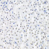 Anti-Phospho-FoxO1-T24/FoxO3a-T32/FoxO4-T28 antibody produced in rabbit