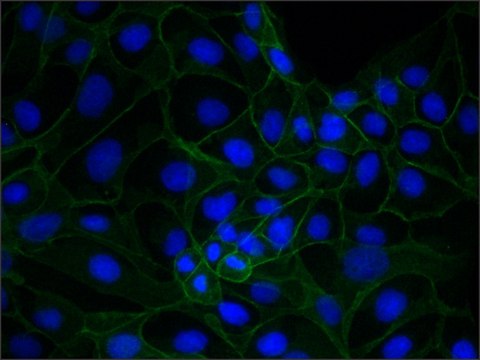 Monoclonal Anti-Plakoglobin (Catenin &#947;) antibody produced in mouse clone 15F11, ascites fluid, buffered aqueous solution