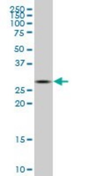 ANTI-CA1 antibody produced in mouse clone 10E4, purified immunoglobulin, buffered aqueous solution