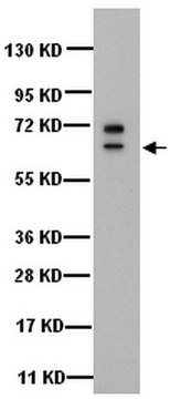 细胞角蛋白5抗体，6，克隆D5/16B4 clone D5/16B4, Chemicon&#174;, from mouse