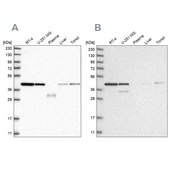 Anti-PPP1R8 antibody produced in rabbit Prestige Antibodies® Powered by Atlas Antibodies, affinity isolated antibody, buffered aqueous glycerol solution, Ab2