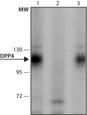 Anti-DPP4 (61-75) antibody produced in rabbit IgG fraction of antiserum, buffered aqueous solution