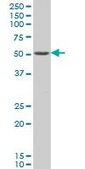 ANTI-PAX8 antibody produced in mouse clone 3G11, purified immunoglobulin, buffered aqueous solution