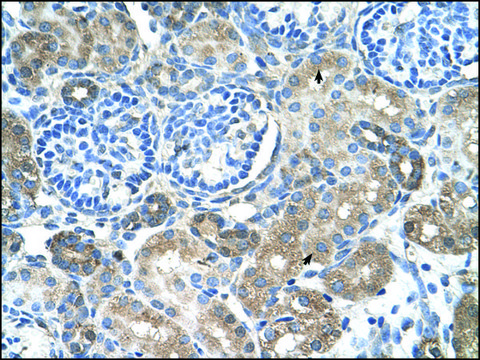 Anti-SLC38A4 antibody produced in rabbit IgG fraction of antiserum