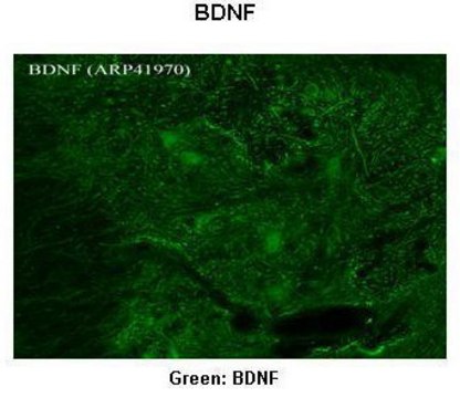 Anti-BDNF antibody produced in rabbit