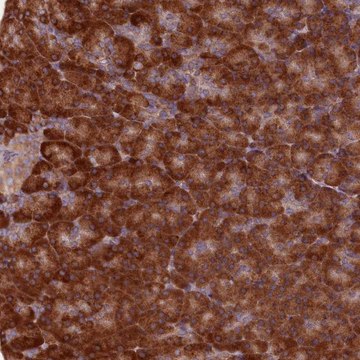 Anti-TBC1D19 antibody produced in rabbit Prestige Antibodies&#174; Powered by Atlas Antibodies, affinity isolated antibody, buffered aqueous glycerol solution