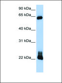 Anti-RHOD (AB2) antibody produced in rabbit affinity isolated antibody