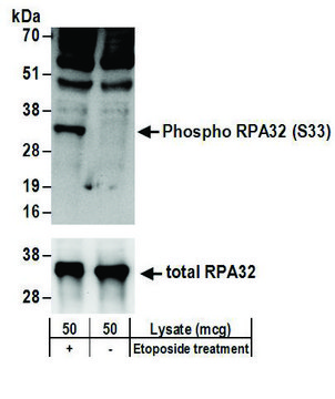 Rabbit anti-Phospho RPA32 (S33) Antibody, Affinity Purified