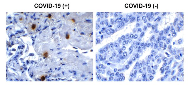 Anti-SARS-CoV-2 (COVID-19) NSP10 antibody produced in rabbit affinity isolated antibody