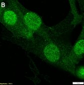 Anti-S100A4 Antibody, clone 1G2 ZooMAb® Rabbit Monoclonal recombinant, expressed in HEK 293 cells