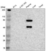 Anti-F12 antibody produced in rabbit Prestige Antibodies® Powered by Atlas Antibodies, affinity isolated antibody, buffered aqueous glycerol solution