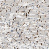 Anti-DSG2 antibody produced in rabbit Prestige Antibodies® Powered by Atlas Antibodies, affinity isolated antibody, buffered aqueous glycerol solution