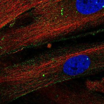 Anti-THBS1 antibody produced in rabbit Prestige Antibodies&#174; Powered by Atlas Antibodies, affinity isolated antibody