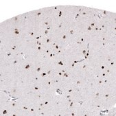 Monoclonal Anti-H2AFY2 antibody produced in mouse Prestige Antibodies® Powered by Atlas Antibodies, clone CL5263, purified immunoglobulin, buffered aqueous glycerol solution