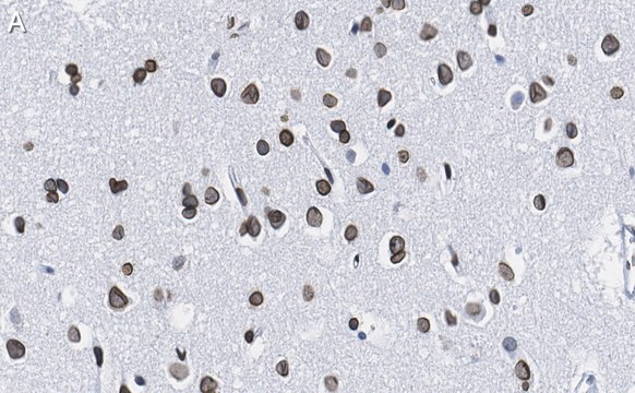 Anti-Lamin A/C Antibody, clone 2B10 ZooMAb&#174; Rabbit Monoclonal recombinant, expressed in HEK 293 cells