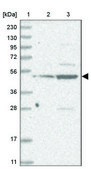 Anti-IL11RA antibody produced in rabbit Prestige Antibodies® Powered by Atlas Antibodies, affinity isolated antibody, buffered aqueous glycerol solution