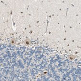 Anti-PSMD8 antibody produced in rabbit Prestige Antibodies® Powered by Atlas Antibodies, affinity isolated antibody, buffered aqueous glycerol solution