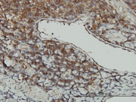 Monoclonal Anti-STK16 antibody produced in mouse clone M2, purified immunoglobulin, buffered aqueous solution