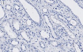 Anti-LRP6 Antibody, clone 1D11 ZooMAb® Rabbit Monoclonal recombinant, expressed in HEK 293 cells