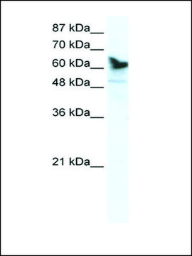 Anti-DDX41 antibody produced in rabbit IgG fraction of antiserum