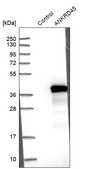Anti-ANKRD45 antibody produced in rabbit Prestige Antibodies® Powered by Atlas Antibodies, affinity isolated antibody, buffered aqueous glycerol solution, ab2