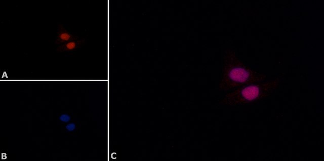 Monoclonal Anti-p53&#8722;Biotin antibody produced in mouse ~1&#160;mg/mL, clone DO-1, ascites fluid, buffered aqueous solution