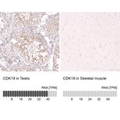 Monoclonal Anti-Cdk19 Antibody Produced In Mouse Prestige Antibodies® Powered by Atlas Antibodies, clone CL14116, affinity isolated antibody, buffered aqueous glycerol solution