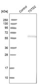 Anti-TSTD2 antibody produced in rabbit Prestige Antibodies® Powered by Atlas Antibodies, affinity isolated antibody, buffered aqueous glycerol solution, Ab2