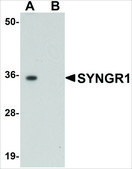 Anti-SYNGR1 antibody produced in rabbit affinity isolated antibody, buffered aqueous solution
