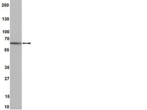 Anti-Estrogen Receptor &#946; Antibody, clone 68-4, rabbit monoclonal culture supernatant, clone 68-4, from rabbit