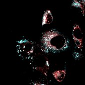 BioTracker™ LD-1 Near-IR Lipid Droplet Live Cell Probe