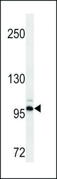 MONOCLONAL ANTI-DDR2 antibody produced in mouse clone 484CT5.5.4, crude ascites, buffered aqueous solution