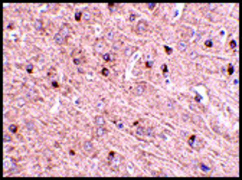 Anti-TOM70 antibody produced in rabbit affinity isolated antibody