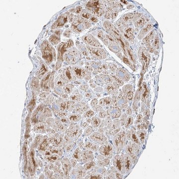 Anti-MTX2 antibody produced in rabbit Prestige Antibodies&#174; Powered by Atlas Antibodies, affinity isolated antibody, buffered aqueous glycerol solution, ab1