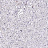 Anti-MS4A12 antibody produced in rabbit Prestige Antibodies® Powered by Atlas Antibodies, affinity isolated antibody, buffered aqueous glycerol solution
