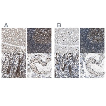 抗-USP28 兔抗 Ab2, Prestige Antibodies&#174; Powered by Atlas Antibodies, affinity isolated antibody, buffered aqueous glycerol solution